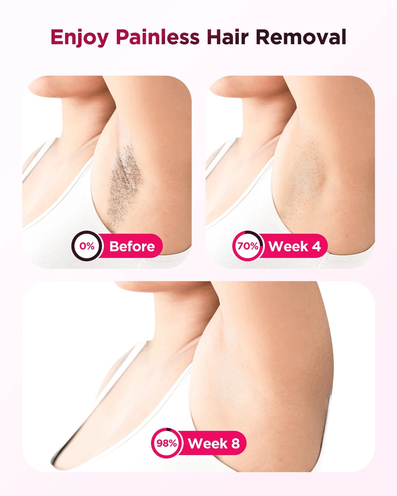 Laser Epilator IPL Hair Removal