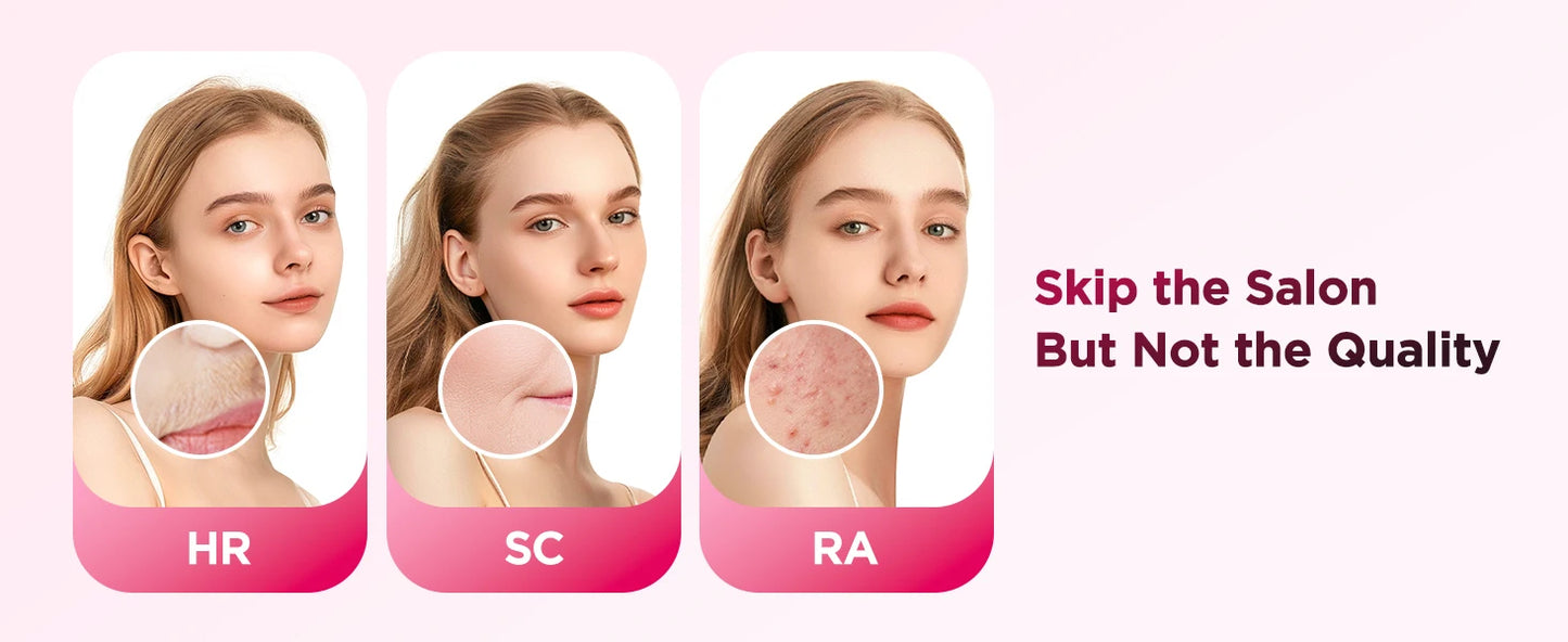 Laser Epilator IPL Hair Removal